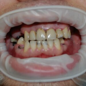 Before image