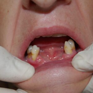 Before image